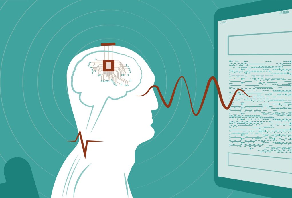 Cina: primi chip cerebrali commerciali approvati
