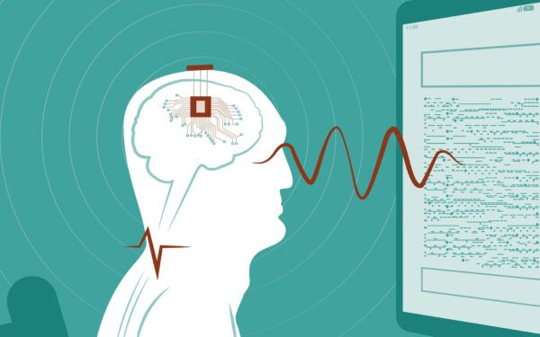 Cina: primi chip cerebrali commerciali approvati